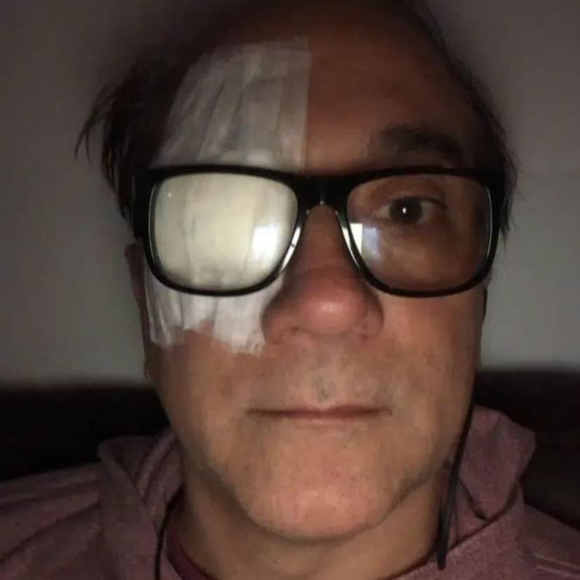 Bruno Gouveia, vocalista da banda Biquini Cavadão após retirada de tumor (Divulgação) Bruno Gouveia, vocalista da banda Biquini Cavadão após retirada de tumor (Divulgação)