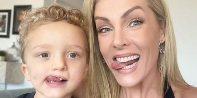 Ana Hickmann mostra antes e depois do sobrinho que nasceu com lábio leporino - Foto: Reprodução Instagram Ana Hickmann mostra antes e depois do sobrinho que nasceu com lábio leporino - Foto: Reprodução Instagram