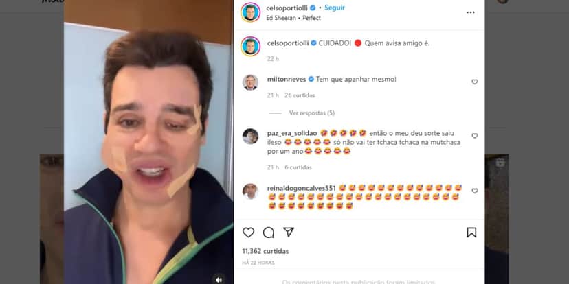 "Cuidado", Celso Portiolli surge com rosto todo deformado em vídeo, expõe surra e motivo: "Nunca esqueça" "Cuidado", Celso Portiolli surge com rosto todo deformado em vídeo, expõe surra e motivo: "Nunca esqueça"