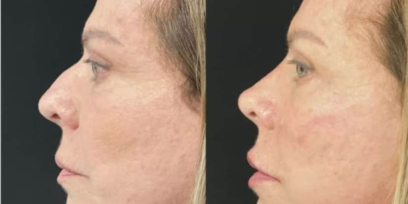Christina Rocha antes e depois de harmonização facial (Foto: Reprodução/Instagram) Christina Rocha antes e depois de harmonização facial (Foto: Reprodução/Instagram)