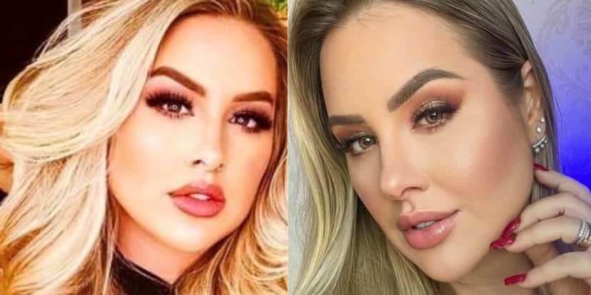 Patrícia Leitte depois dos procedimentos estéticos - Reprodução Patrícia Leitte depois dos procedimentos estéticos - Reprodução