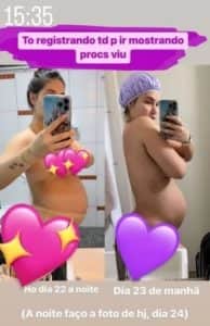Virginia Fonseca compartilhou as mudanças em seu corpo após o nascimento de Maria Flor (Foto: Reprodução / Instagram) Virginia Fonseca compartilhou as mudanças em seu corpo após o nascimento de Maria Flor (Foto: Reprodução / Instagram)