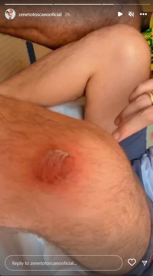 Cantor Zé Neto, da dupla com Christiano, mostra joelho machucado após pagar promessa - Foto Reprodução Instagram Cantor Zé Neto, da dupla com Christiano, mostra joelho machucado após pagar promessa - Foto Reprodução Instagram