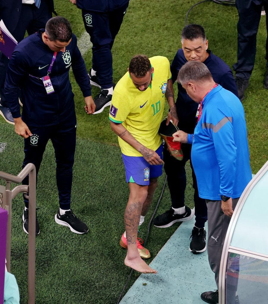Tornozelo do Neymae extremamente inchado pós jogo (Reprodução) Tornozelo do Neymae extremamente inchado pós jogo (Reprodução)