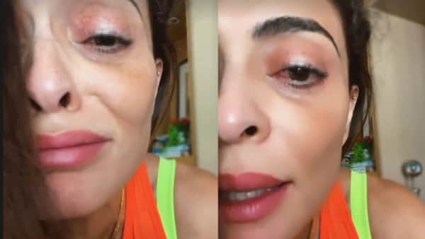 Juliana Paes surgiu com o olho inchado e vermelho (Foto: Reprodução) Juliana Paes surgiu com o olho inchado e vermelho (Foto: Reprodução)