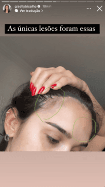 Ex-BBB Gizelly Bichalho sofre acidente de carro e desabafa sobre o ocorrido que deixou o veículo destruído - Foto Reprodução Ex-BBB Gizelly Bichalho sofre acidente de carro e desabafa sobre o ocorrido que deixou o veículo destruído - Foto Reprodução