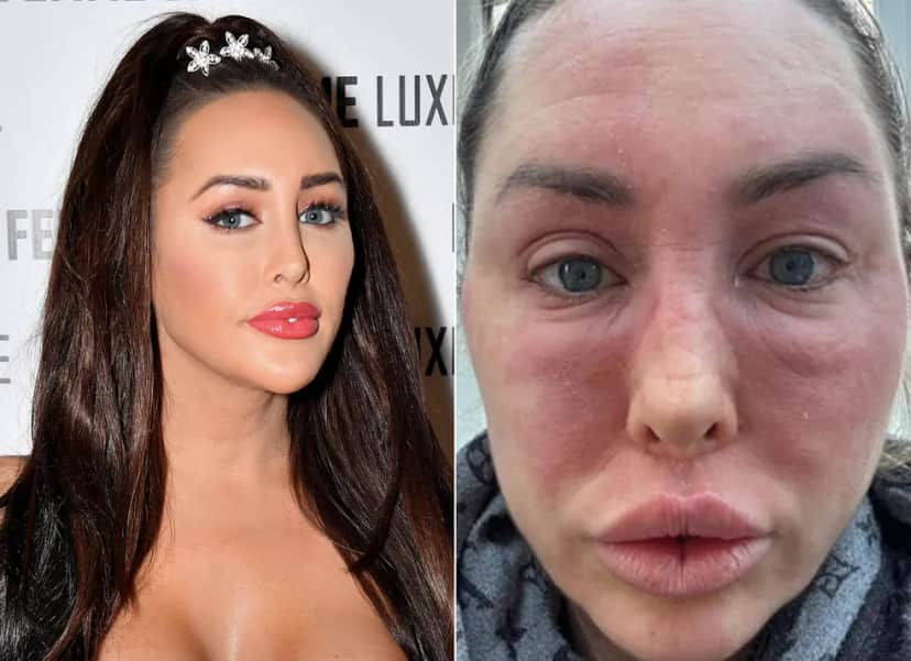 Desfigurada, estrela de reality é hospitalizada às pressas - Foto Reprodução Desfigurada, estrela de reality é hospitalizada às pressas - Foto Reprodução