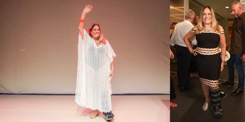 Susana Vieira caiu na rua e quebrou o quinto metatarso do pé esquerdo um dia antes de se apresentar no teatro (Foto: Lucas Ramos Brazil News) Susana Vieira caiu na rua e quebrou o quinto metatarso do pé esquerdo um dia antes de se apresentar no teatro (Foto: Lucas Ramos Brazil News)