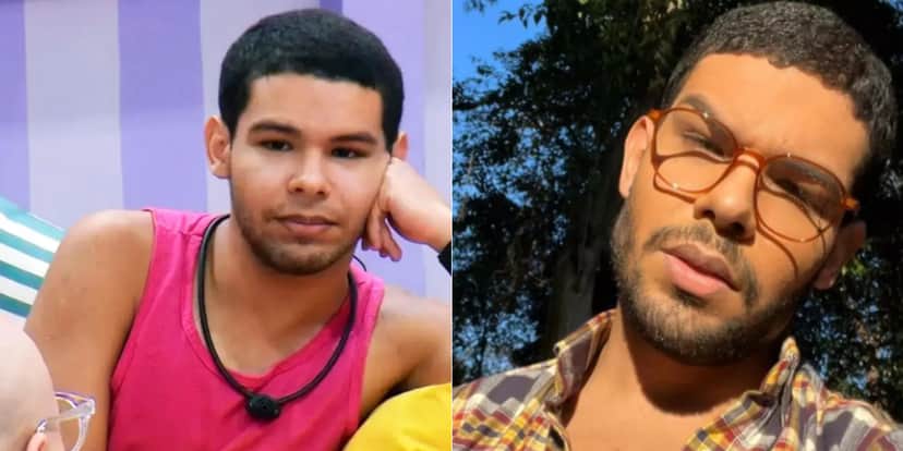 viny do BBB 22, antes e depois dos procedimentos no rosto - Foto: Reprodução viny do BBB 22, antes e depois dos procedimentos no rosto - Foto: Reprodução