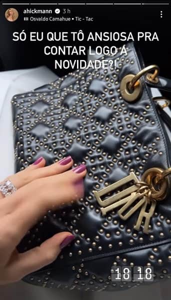 Publicação de Ana Hickmann nos stories (Foto: Reprodução/ Instagram Publicação de Ana Hickmann nos stories (Foto: Reprodução/ Instagram