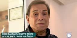 Novo rosto de Dedé Santana é mostrado no Domingo Espetacular e horroriza público: “Várias agulhadas”
