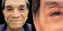 Procedimento no rosto que Dedé Santana acaba de fazer o faz rejuvenescer 30 anos e fotos provam