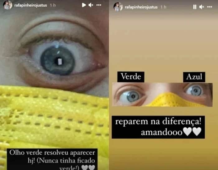 Rafa Justus tira fotos bem de perto dos olhos e mostra ao público as alterações de cores Fotos Reprodução Instagram Rafa Justus tira fotos bem de perto dos olhos e mostra ao público as alterações de cores Fotos Reprodução Instagram