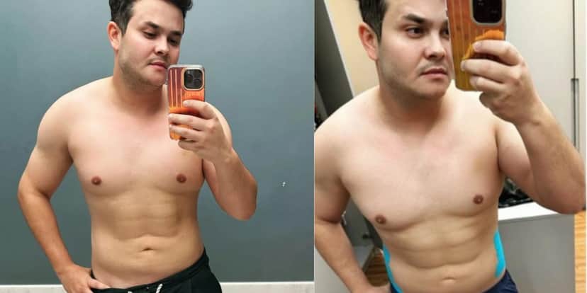 Matheus fez Lipo para perder gordura (Reprodução: Instagram) Matheus fez Lipo para perder gordura (Reprodução: Instagram)