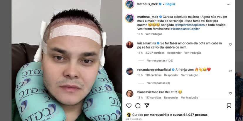 Matheus faz transplante capilar (Foto: Reprodução / Instagram) Matheus faz transplante capilar (Foto: Reprodução / Instagram)