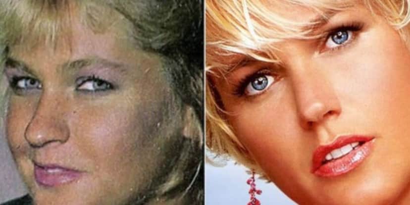 Antes e depois de nariz de Xuxa (Foto: Reprodução / Extra) Antes e depois de nariz de Xuxa (Foto: Reprodução / Extra)