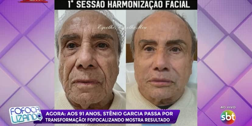 Antes e depois de Stênio Garcia (Foto: Reprodução/SBT) Antes e depois de Stênio Garcia (Foto: Reprodução/SBT)