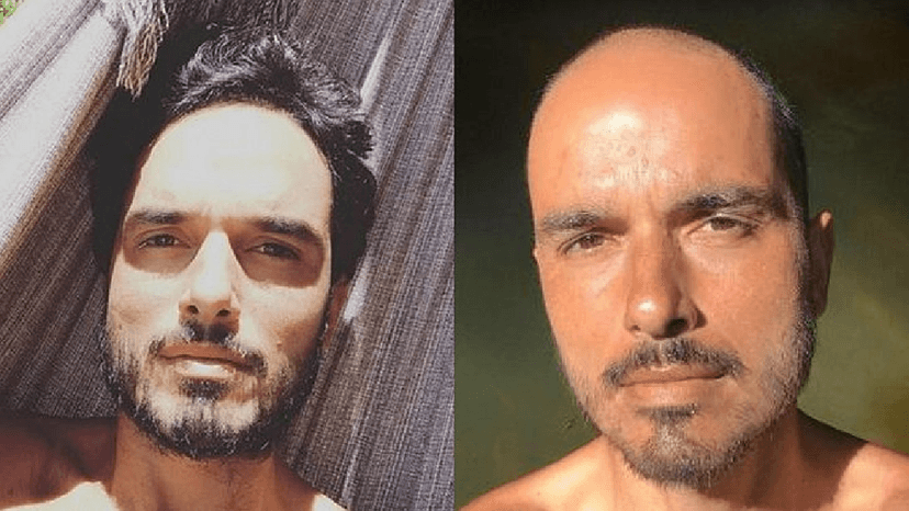 Antes e depois do ator (Foto: Reprodução/ Internet) Antes e depois do ator (Foto: Reprodução/ Internet)