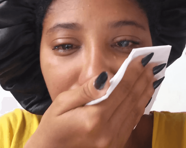 Mulher lacrimejando após uso de pomada (Foto: Reprodução/ Internet) Mulher lacrimejando após uso de pomada (Foto: Reprodução/ Internet)