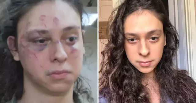 o ator, Victor Meyniel antes e depois do espancamento - Foto Reprodução Internet o ator, Victor Meyniel antes e depois do espancamento - Foto Reprodução Internet