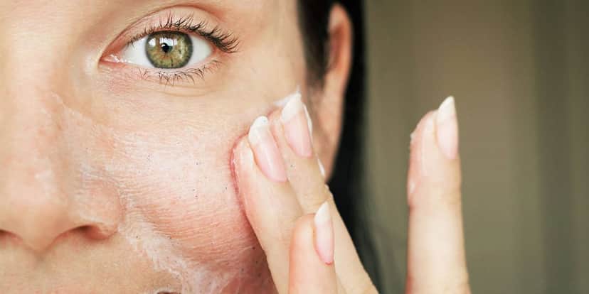 Dicas de beleza para a pele do rosto (Foto: Reprodução, Blog DICADAMULHER) Dicas de beleza para a pele do rosto (Foto: Reprodução, Blog DICADAMULHER)