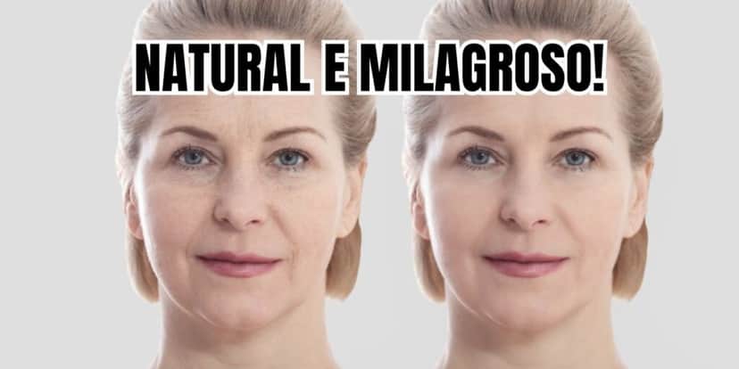 Colágeno natural deixa o botox no chinelo e acaba com as rugas (Reprodução/Montagem TV Foco) Colágeno natural deixa o botox no chinelo e acaba com as rugas (Reprodução/Montagem TV Foco)