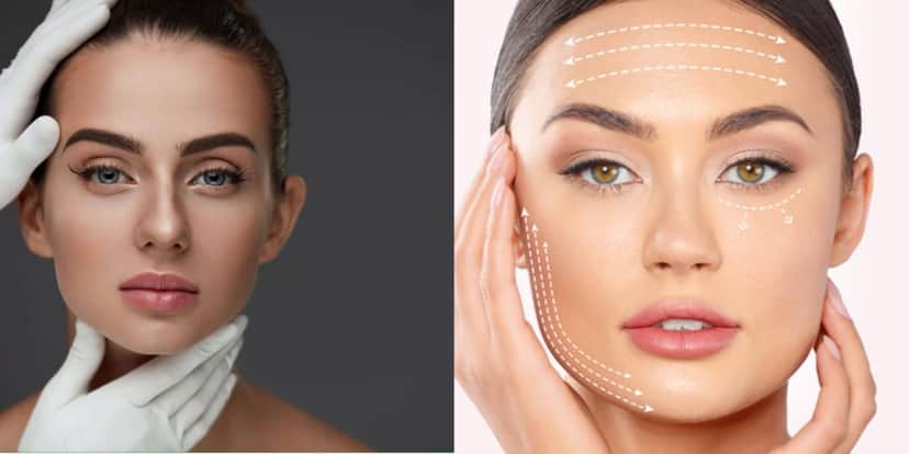 Receitinha caseira melhor que harmonização facial (Foto: Reprodução/ Internet) Receitinha caseira melhor que harmonização facial (Foto: Reprodução/ Internet)
