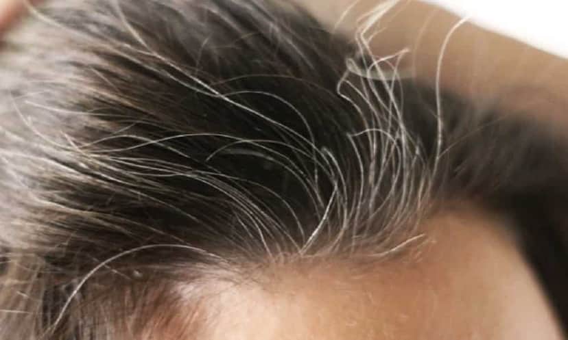 Cabelos brancos muitas vezes são motivos de preocupação para algumas mulheres (Foto: Reprodução/Internet) Cabelos brancos muitas vezes são motivos de preocupação para algumas mulheres (Foto: Reprodução/Internet)