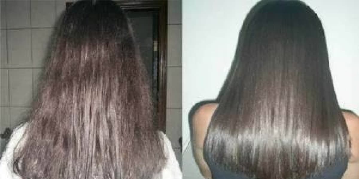Antes de depois do creme dos cabelos (Foto: Reprodução/ Internet) Antes de depois do creme dos cabelos (Foto: Reprodução/ Internet)