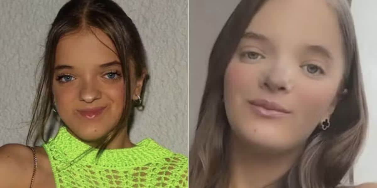 Antes e depois de cirurgia de Rafinha Justus (Foto: Reprodução / Instagram / Motagem) Antes e depois de cirurgia de Rafinha Justus (Foto: Reprodução / Instagram / Motagem)