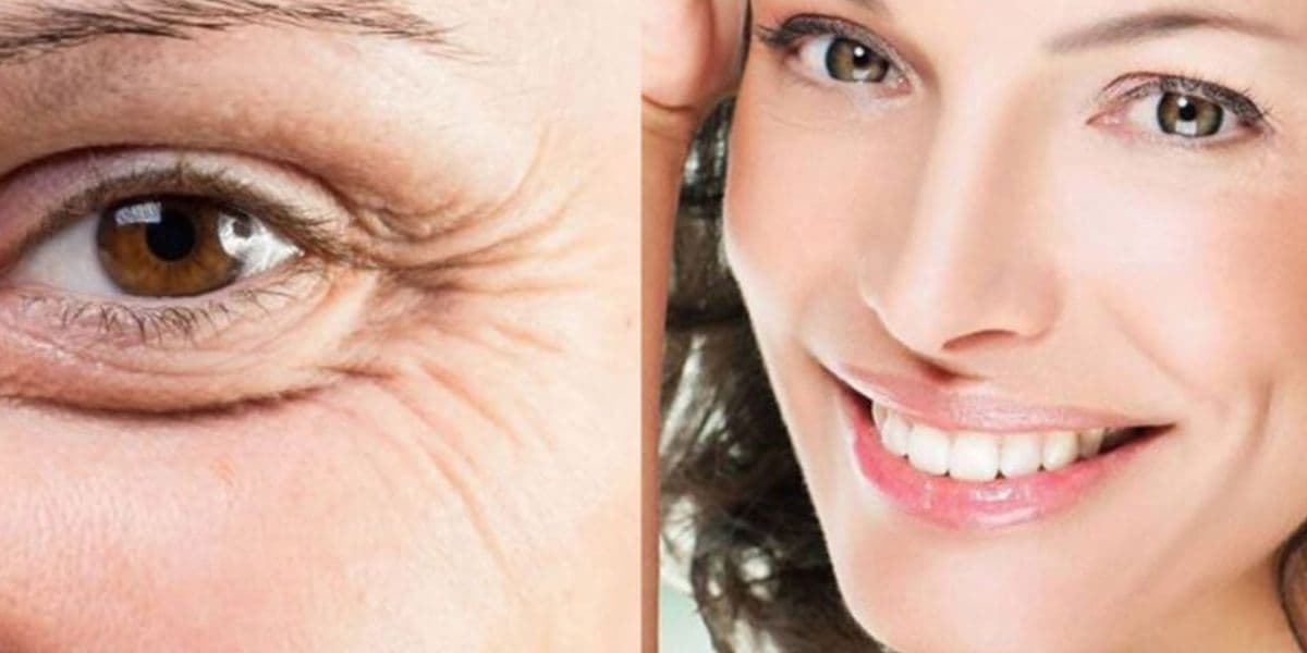 Imagem do post Imagem do post