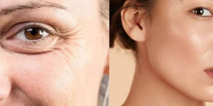 Mulher com rugas / Mulher sem rugas - Montagem TVFOCO Mulher com rugas / Mulher sem rugas - Montagem TVFOCO