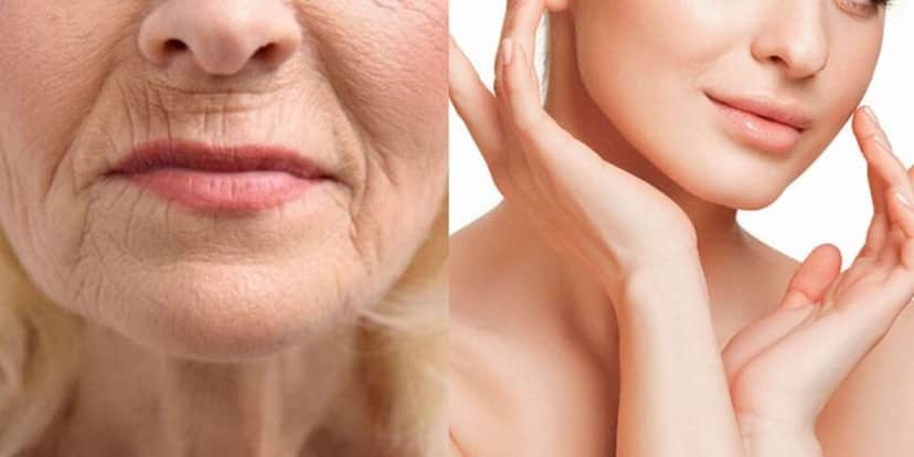 Mulher com rugas / Mulher sem rugas - Montagem TVFOCO Mulher com rugas / Mulher sem rugas - Montagem TVFOCO