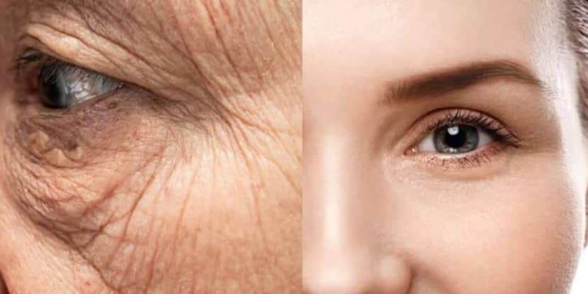 Harmonização facial caseira suga rugas e faz melhor que o botox - (Foto: Reprodução / Internet) Harmonização facial caseira suga rugas e faz melhor que o botox - (Foto: Reprodução / Internet)