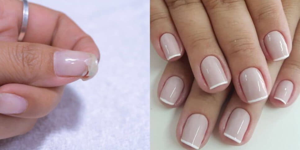 Se livre das unhas quebradiças seguindo esses 5 passos (Foto: Reprodução/ Internet) Se livre das unhas quebradiças seguindo esses 5 passos (Foto: Reprodução/ Internet)