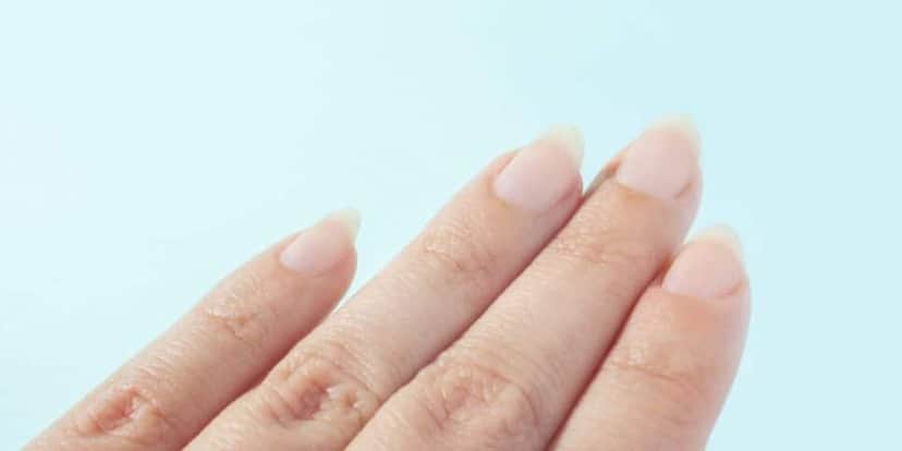 Unha sem esmalte (Foto: Reprodução / Canva) Unha sem esmalte (Foto: Reprodução / Canva)