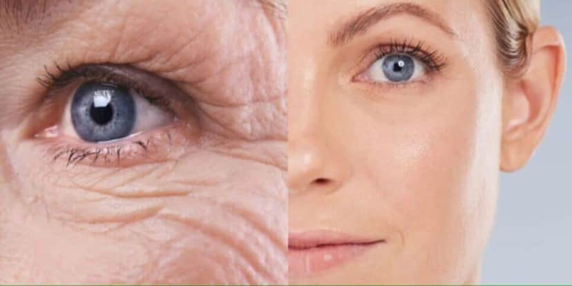 Melhor botox natural do mundo salva mulheres - (Foto: Reprodução / Internet) Melhor botox natural do mundo salva mulheres - (Foto: Reprodução / Internet)