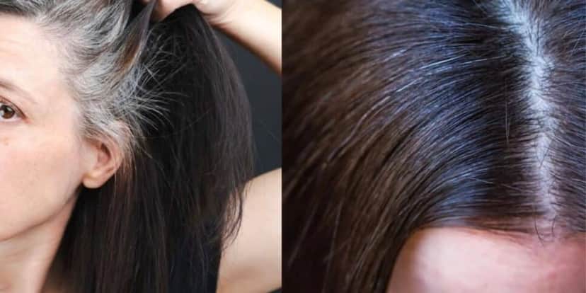 Cabelo grisalho - Montagem: TVFOCO Cabelo grisalho - Montagem: TVFOCO