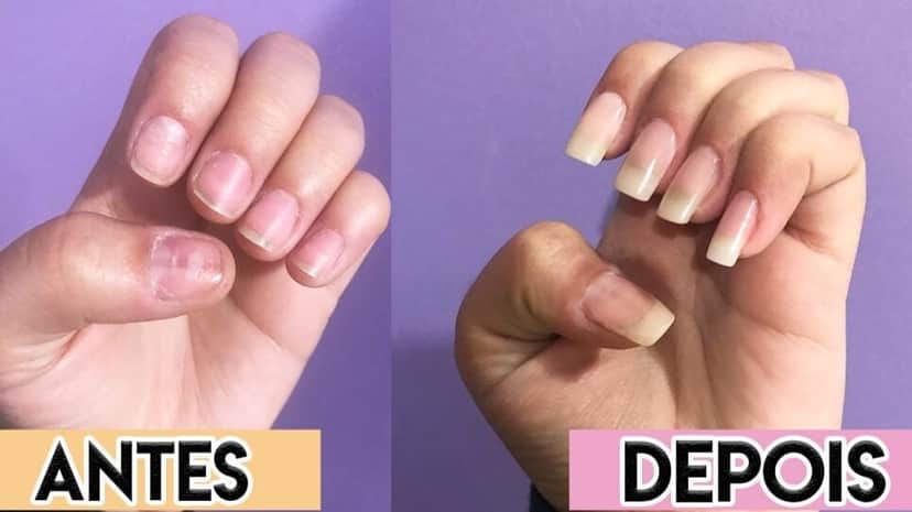 Alongamento de unhas caseiro (Foto: Reprodução/ Internet) Alongamento de unhas caseiro (Foto: Reprodução/ Internet)