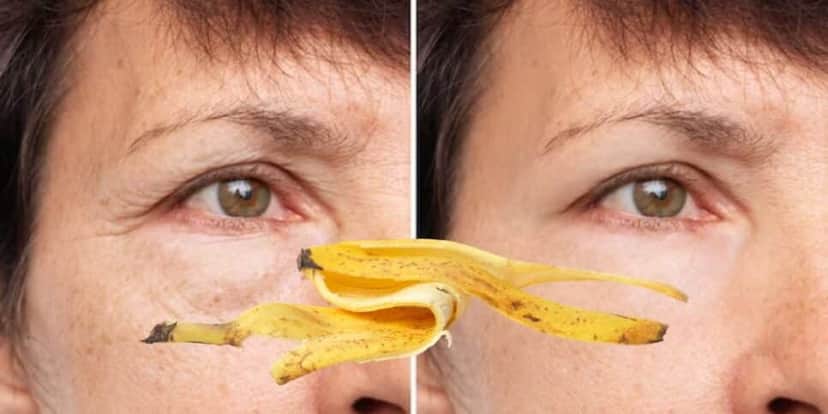 2 ingredientes, incluindo a casca de banana, dão fim nas rugas (Reprodução/Montagem/Freepik/Canva) 2 ingredientes, incluindo a casca de banana, dão fim nas rugas (Reprodução/Montagem/Freepik/Canva)