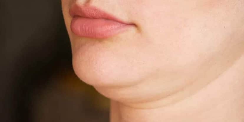 Adeus papada com essa receita (Foto: Divulgação) Adeus papada com essa receita (Foto: Divulgação)