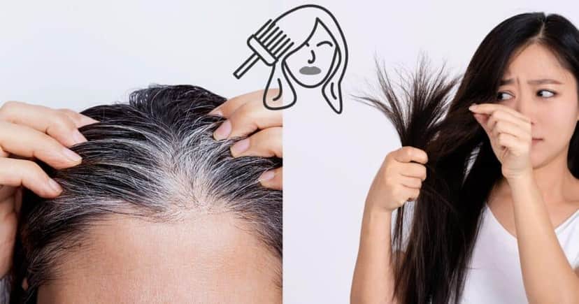 Cabelo brancos e tinta (Reprodução - Internet) Cabelo brancos e tinta (Reprodução - Internet)