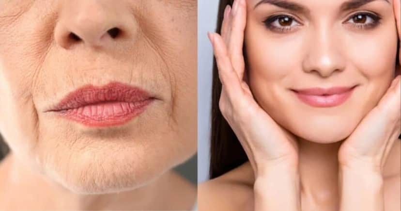 Harmonização facial caseira em 15 min (Foto: Reprodução/ Internet) Harmonização facial caseira em 15 min (Foto: Reprodução/ Internet)