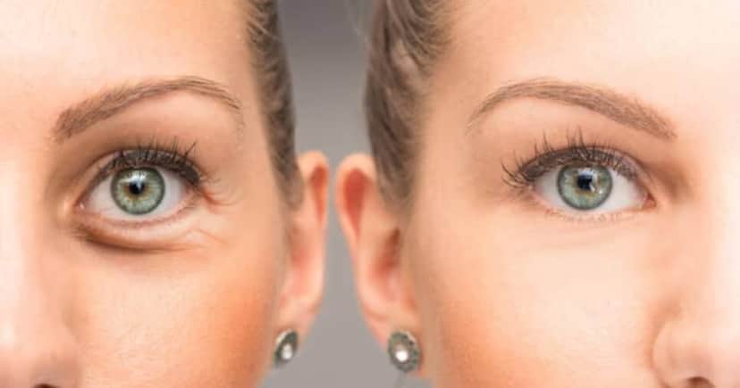 Adeus pés de galinha com essa receita prática (Foto:Freepik) Adeus pés de galinha com essa receita prática (Foto:Freepik)