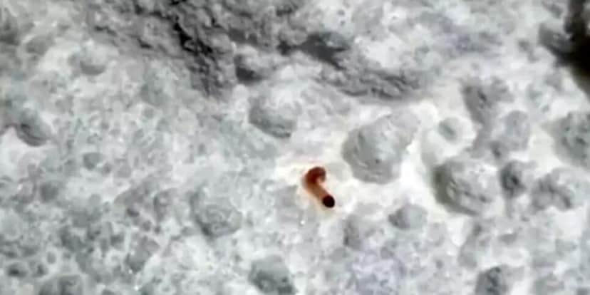 Larvas encontrada na queratina (Foto Reprodução/Globo) Larvas encontrada na queratina (Foto Reprodução/Globo)