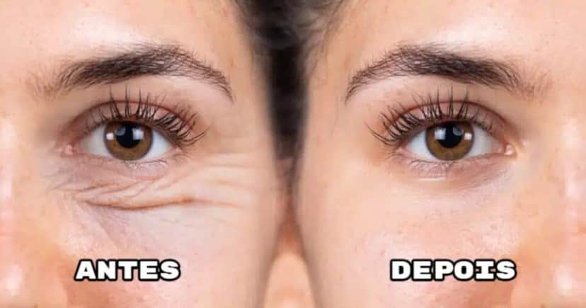 Receitinha com 3 ingredientes elimina rugas e manchas - Foto: Internet Receitinha com 3 ingredientes elimina rugas e manchas - Foto: Internet