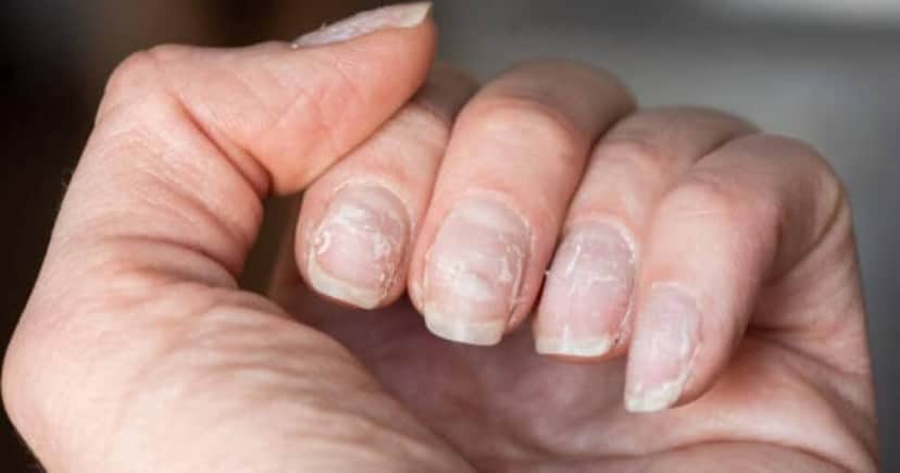 Veja como ter unhas mais saudáveis de forma natural (Foto: Reprodução/iStock) Veja como ter unhas mais saudáveis de forma natural (Foto: Reprodução/iStock)