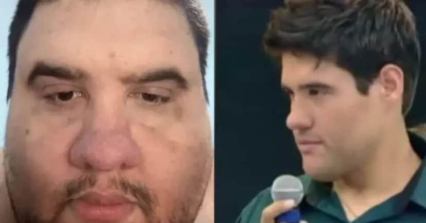 Quem era Gabriel Freitas, influencer de 37 anos que tentava sair dos 300 quilos - Foto Reprodução Internet Quem era Gabriel Freitas, influencer de 37 anos que tentava sair dos 300 quilos - Foto Reprodução Internet