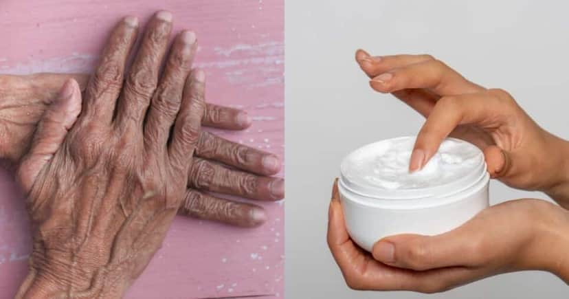 Clareamento com 4 ingredientes suga ressecamento das mãos (Reprodução/Montagem TV Foco/Canva) Clareamento com 4 ingredientes suga ressecamento das mãos (Reprodução/Montagem TV Foco/Canva)