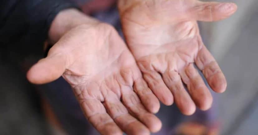 Receitinha caseira para pés e mãos rachadas - Foto: Internet Receitinha caseira para pés e mãos rachadas - Foto: Internet